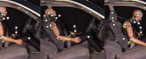 Concussion and whiplash Injury