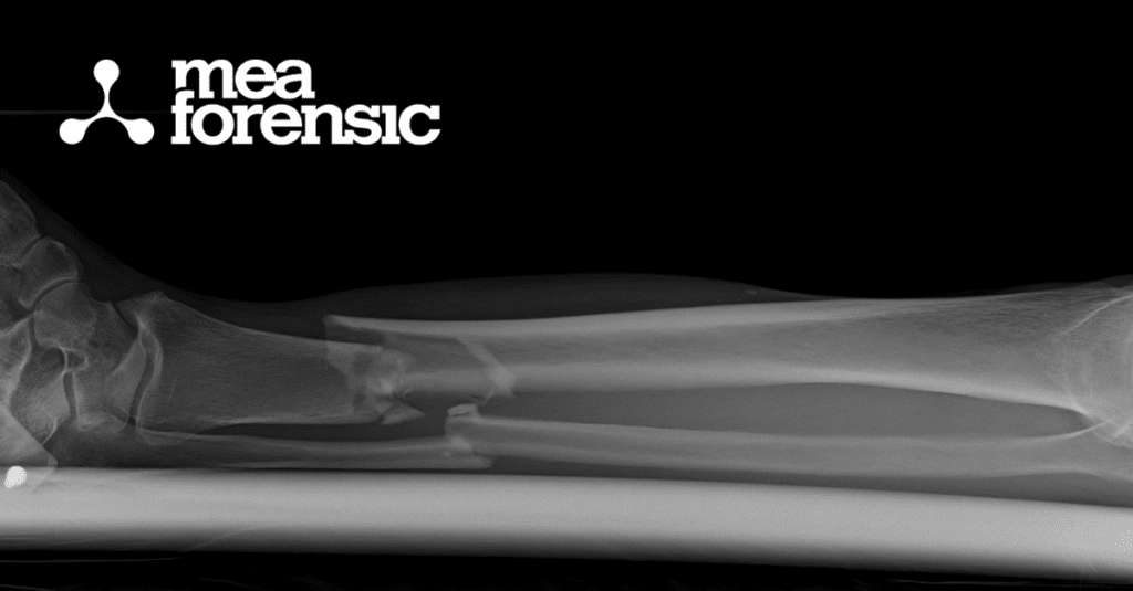 From Falls to Shootings: Diverse Applications of Injury Biomechanics