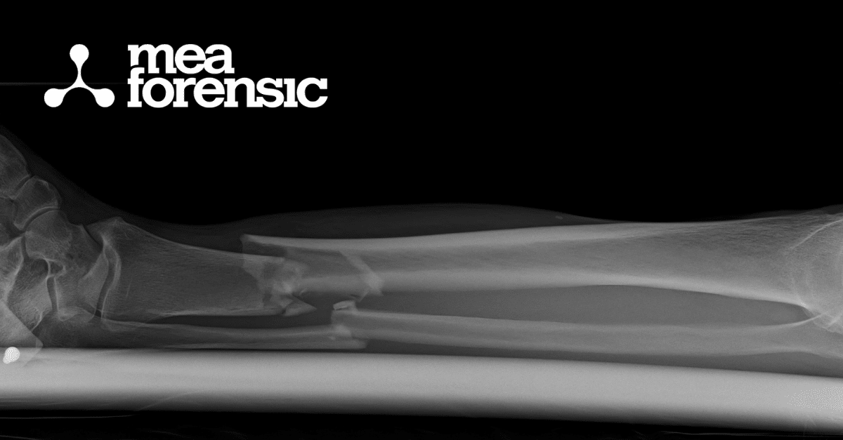 From Falls to Shootings: Diverse Applications of Injury Biomechanics
